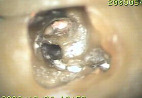 歯の内部をマイクロスコープで確認
